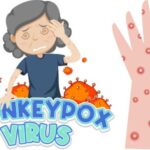 <strong>Monkeypox: Understanding the Virus, Symptoms, and Prevention Strategies</strong>