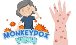 Monkeypox: Understanding the Virus, Symptoms, and Prevention Strategies